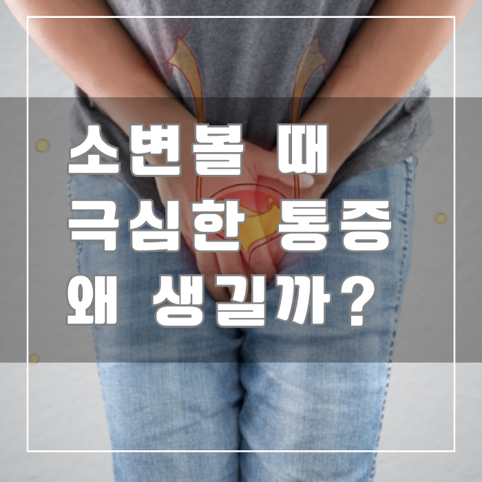 소변볼 때 극심한 통증 왜 생길까?