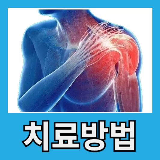 치료방법