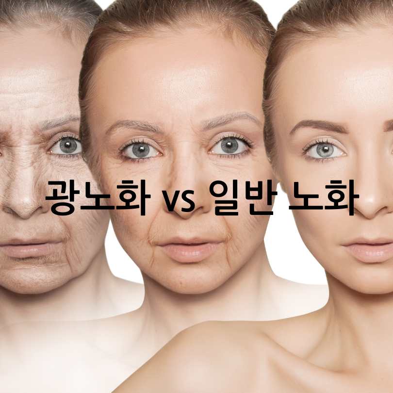 광노화와 일반 노화 차이&amp;#44; 피부 광노화 막는법