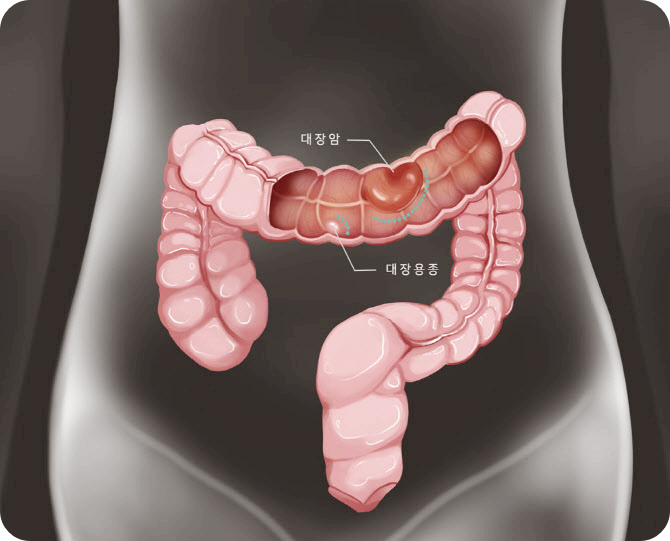 콤부차-효능