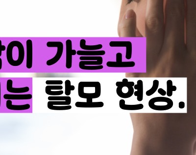 다낭성 난소증후군 증상