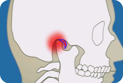 턱관절-통증,소리의-위치