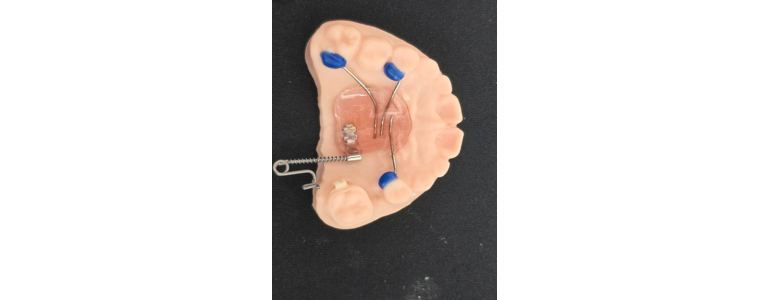 고양 덕양구 교정 치과