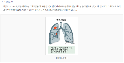 대세포암