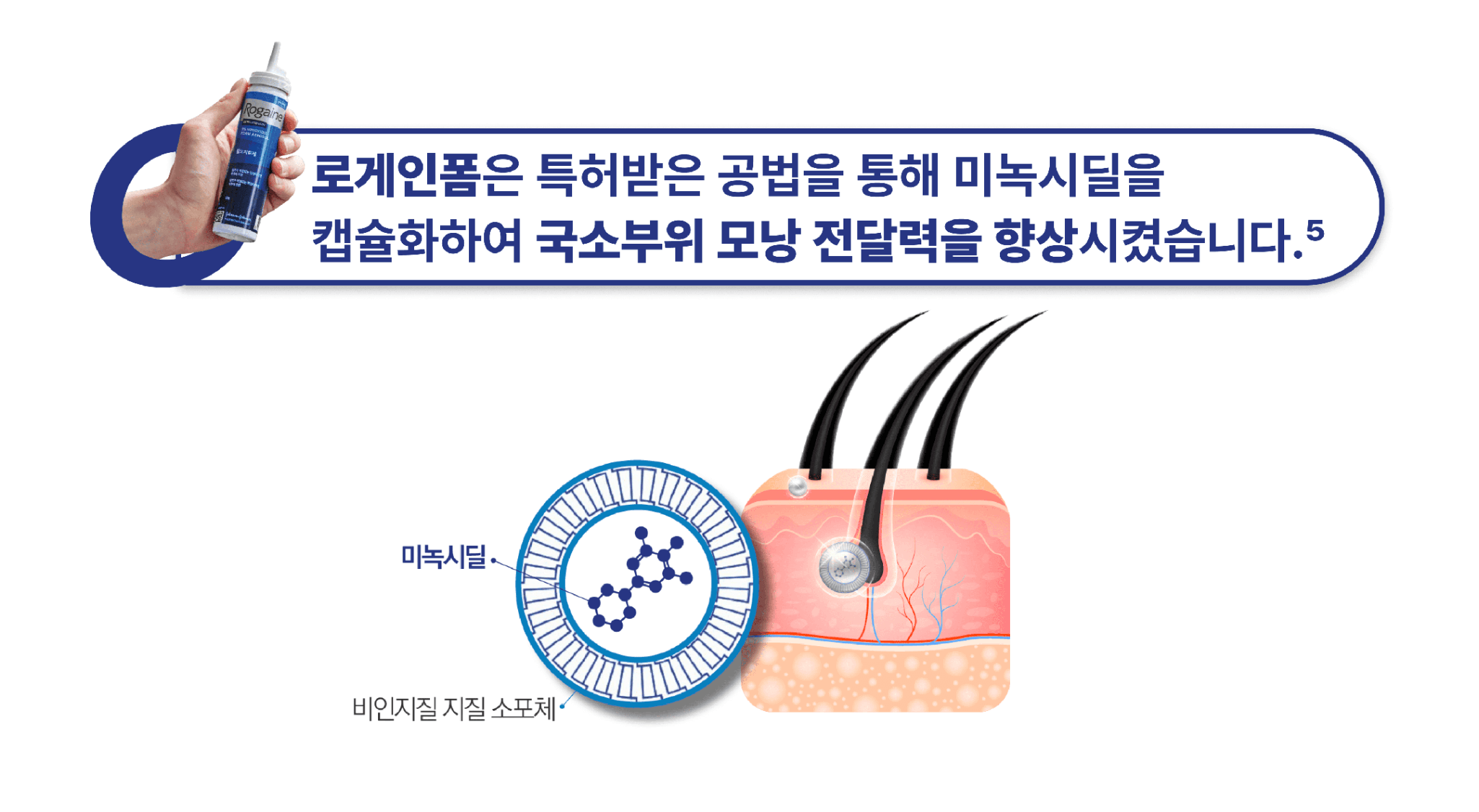 로게인폼 직구2