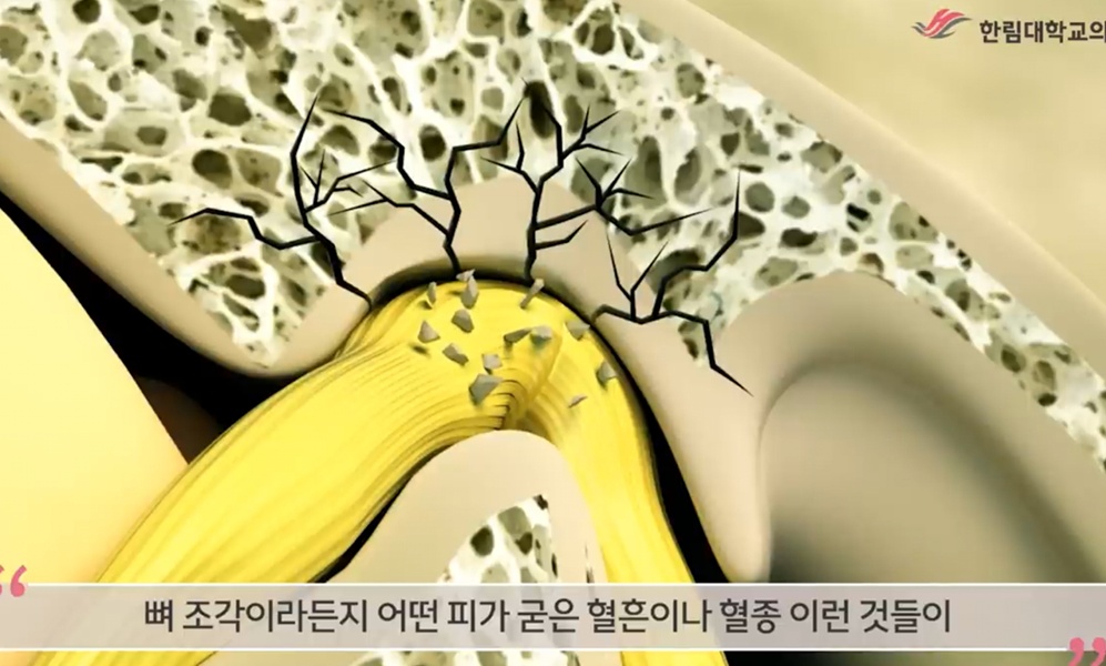 -안면마비-김진-교수