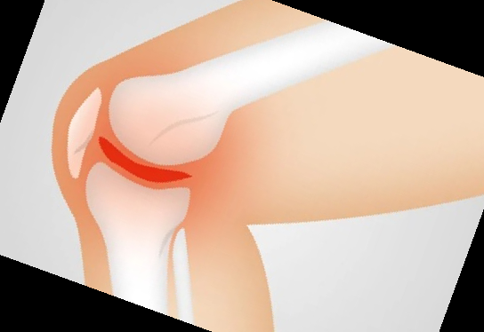 콘쥬란 주사 가격