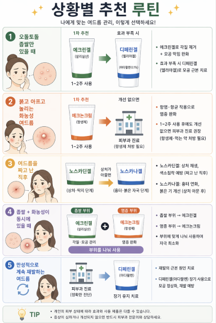 여드름 단계별 관리 루틴 인포그래픽으로 좁쌀, 화농성, 압출 후 상처, 흉터, 만성 여드름 상황에 따른 연고 추천(에크린겔, 에크논크림, 디페린겔, 노스카딘겔, 노스카나겔)과 치료 방법을 정리한 이미지