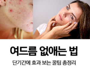 여드름 없애는 법
