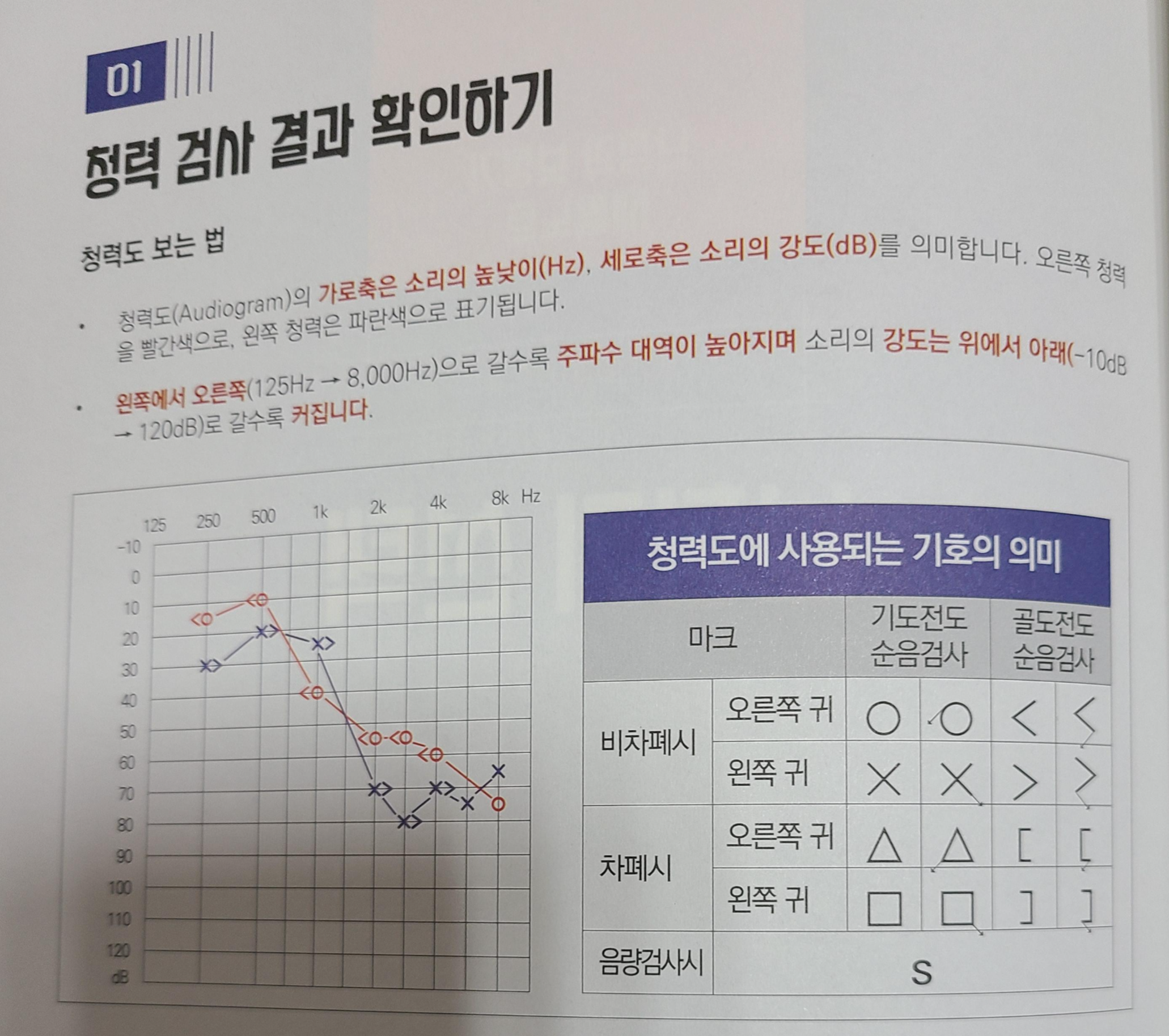 청력 검사 결과 확인 방법