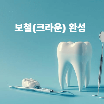 5단계: 보철(크라운) 완성