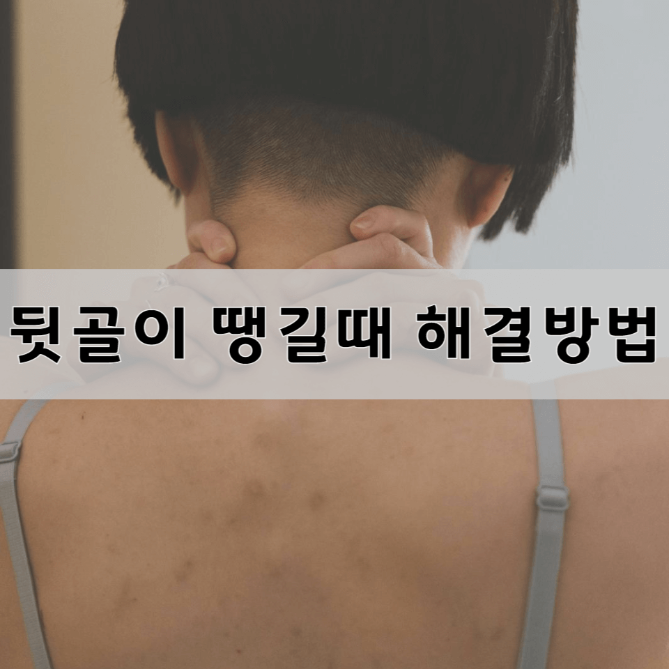 뒷골이-땡길때-해결-방법