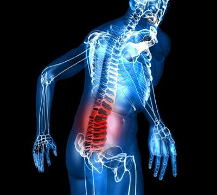 허리 삐끗, 요추염좌의 심층적 이해와 효과적인 회복 전략