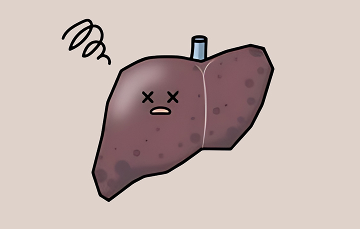 간경변증이-있는-간의-모습