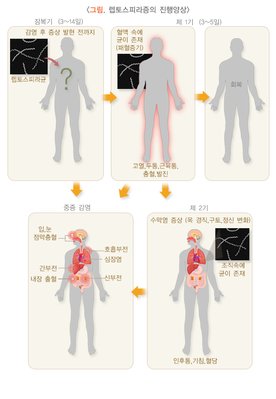 렙토스피라증의 증상