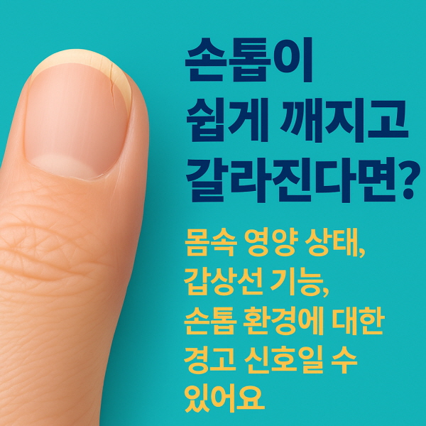 손톱이 쉽게 깨지고 갈라진다면?/gpt
