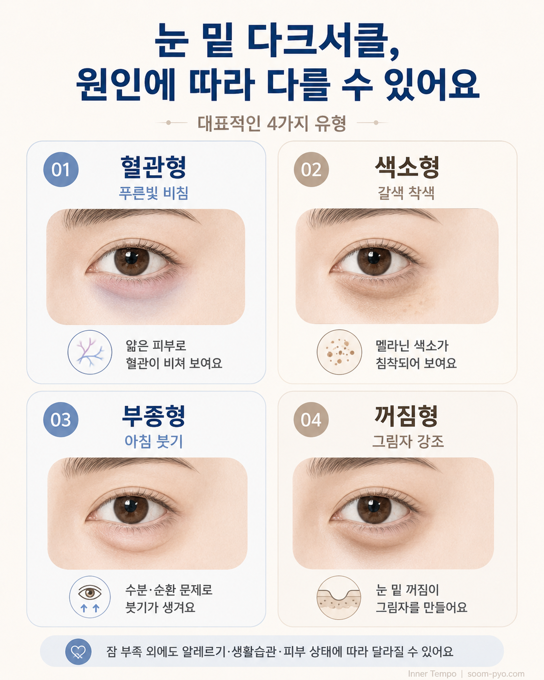 다크서클 유형별 안내 포스터
