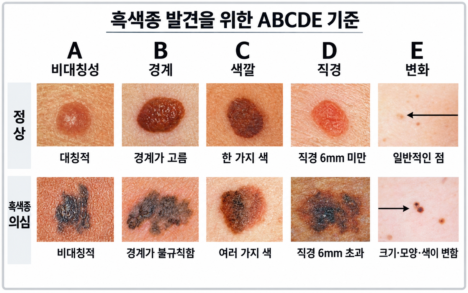 자외선이 미치는 영향