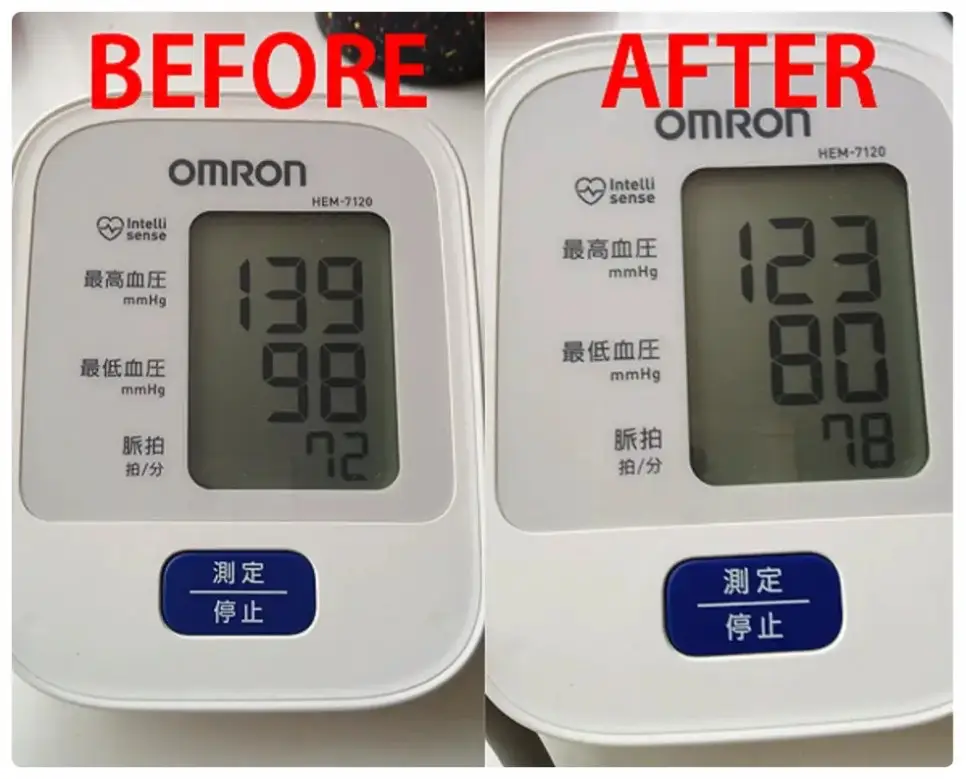 코엔자임Q10