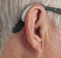 귀에서 삐소리가 나는 이유 이명 원인 대처법