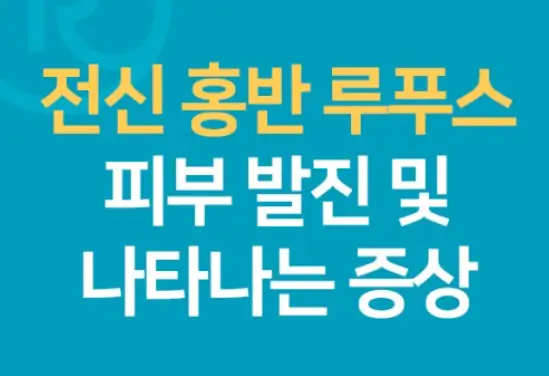 루푸스