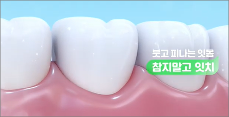 잇치치약 사용후기