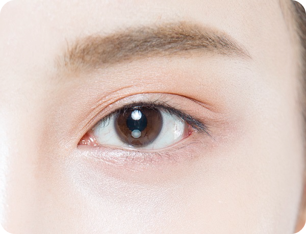 안구-건조증-증상