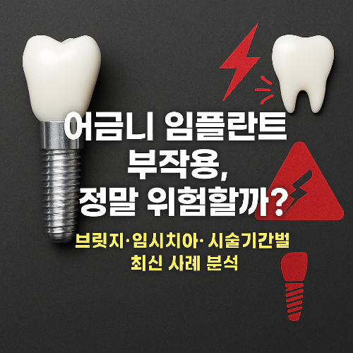 어금니 임플란트 부작용, 정말 위험할까? 최신 사례 분석