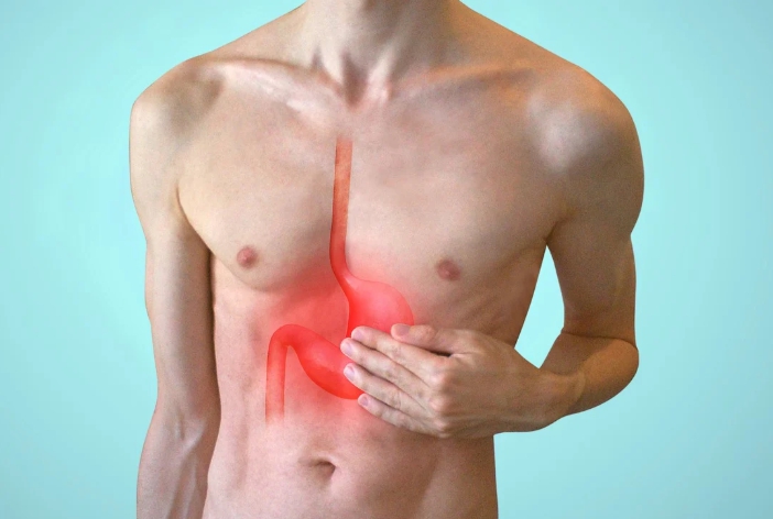 역류성 식도염 증상별 관리법