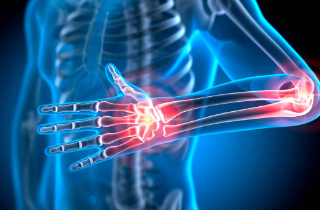 손목 통증 치료