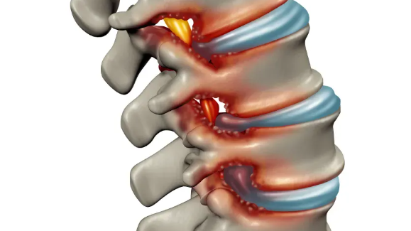 발등이 찌릿찌릿 증상
