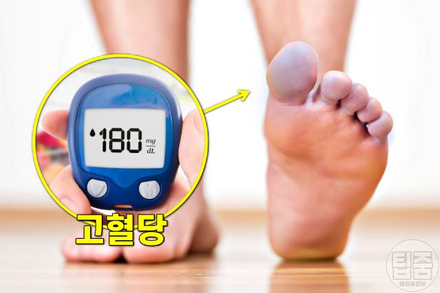 손발이 찬 이유,손발이 찬 체질,수족냉증,당뇨 신경손상