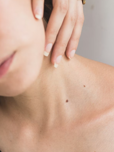 림프절염 증상, 원인, 급성, 결핵성 (목 사타구니 서혜부 겨드랑이)