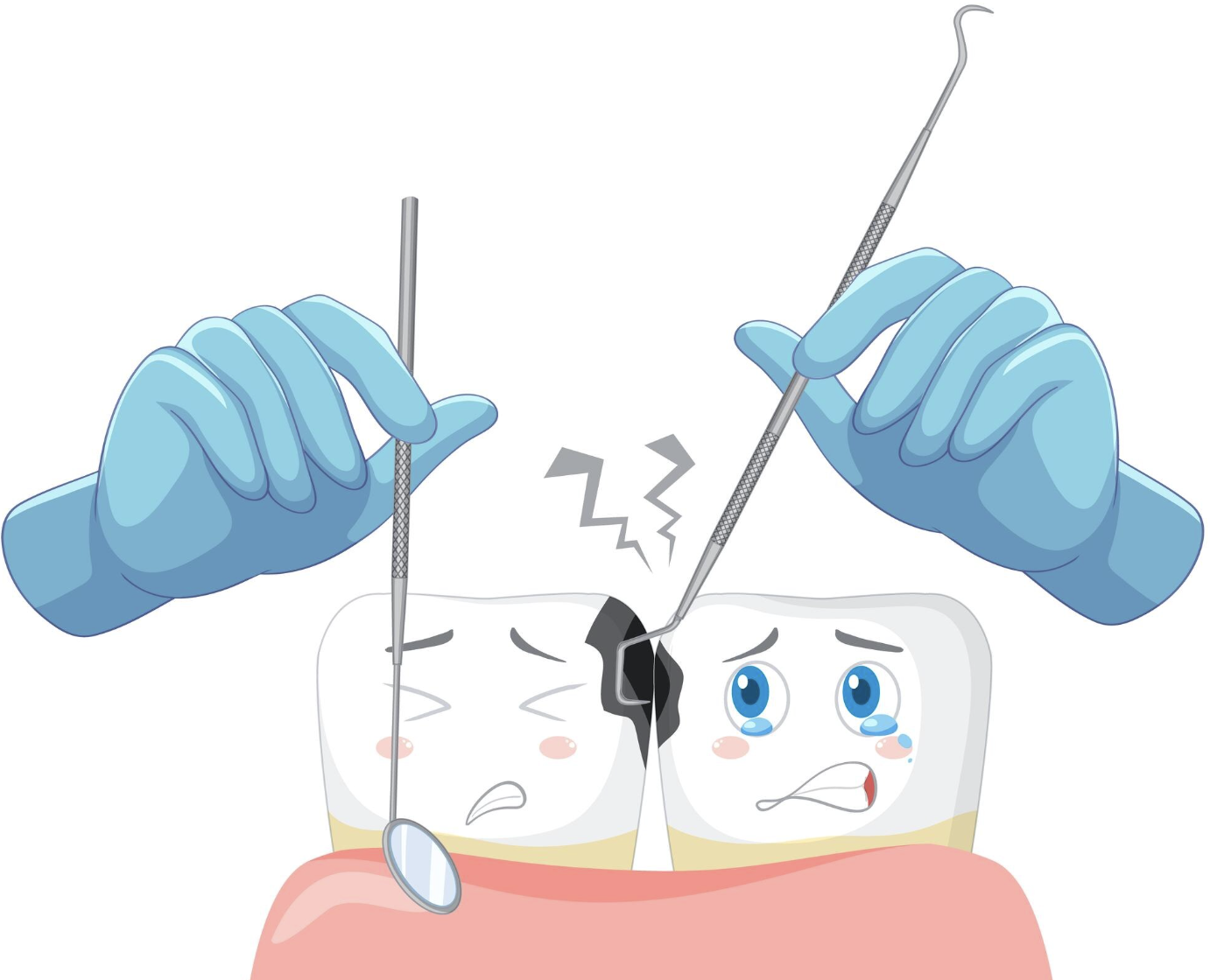 충치치료 크라운 레진 종류 비용 단계별 2026년 최신정보