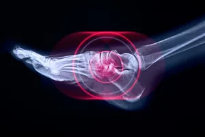 발목-통증-원인