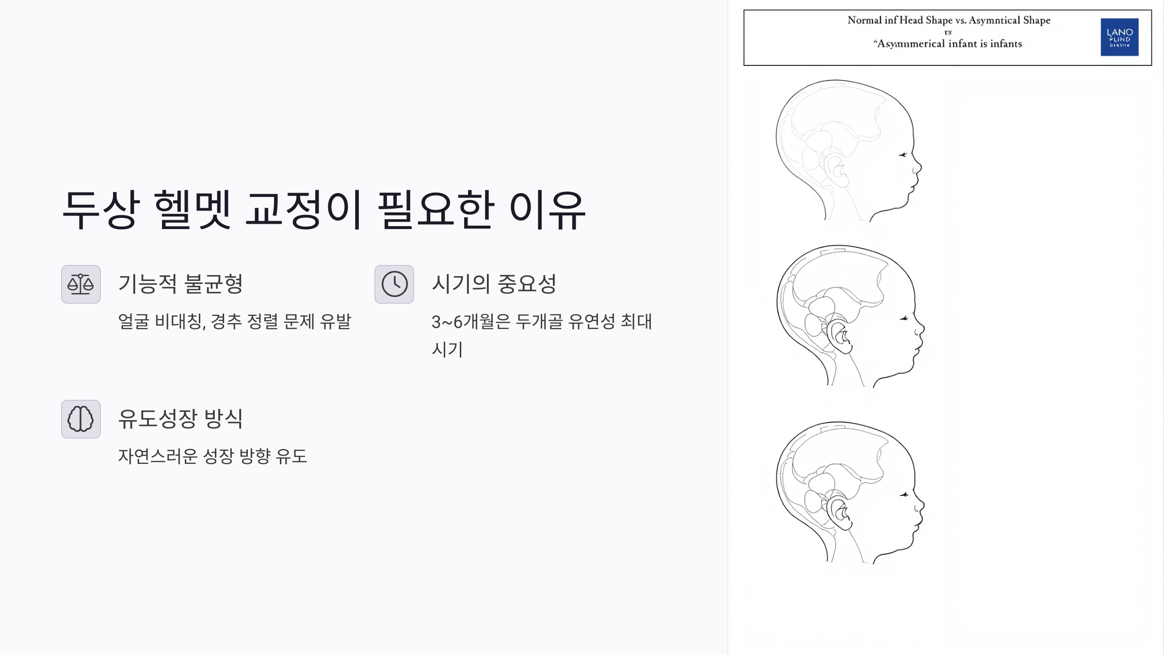 두상 헬멧 교정이 꼭 필요한 이유