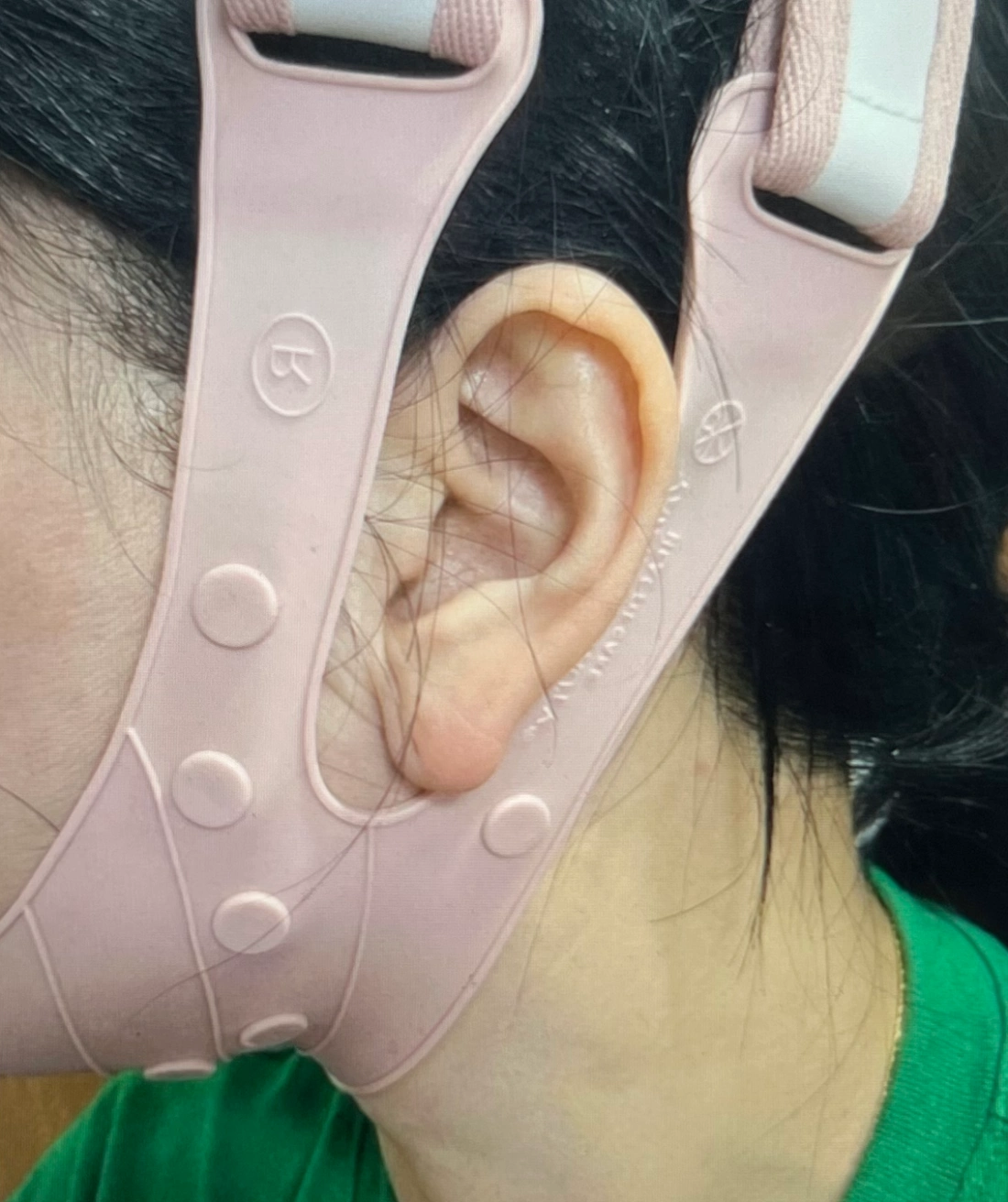 약손명가-리프팅밴드-내돈내산-후기-증명-사진