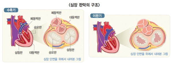  심장판막증 수술 비용 