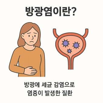 방광염 원인, 주요증상 및 치료법
