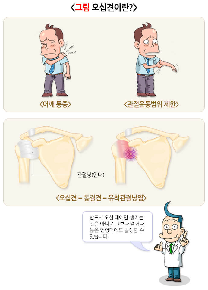 오십견