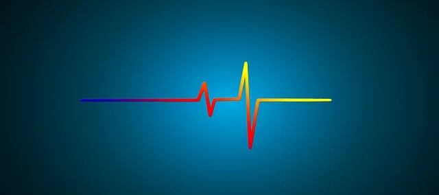 WPW증후군 관련 사진