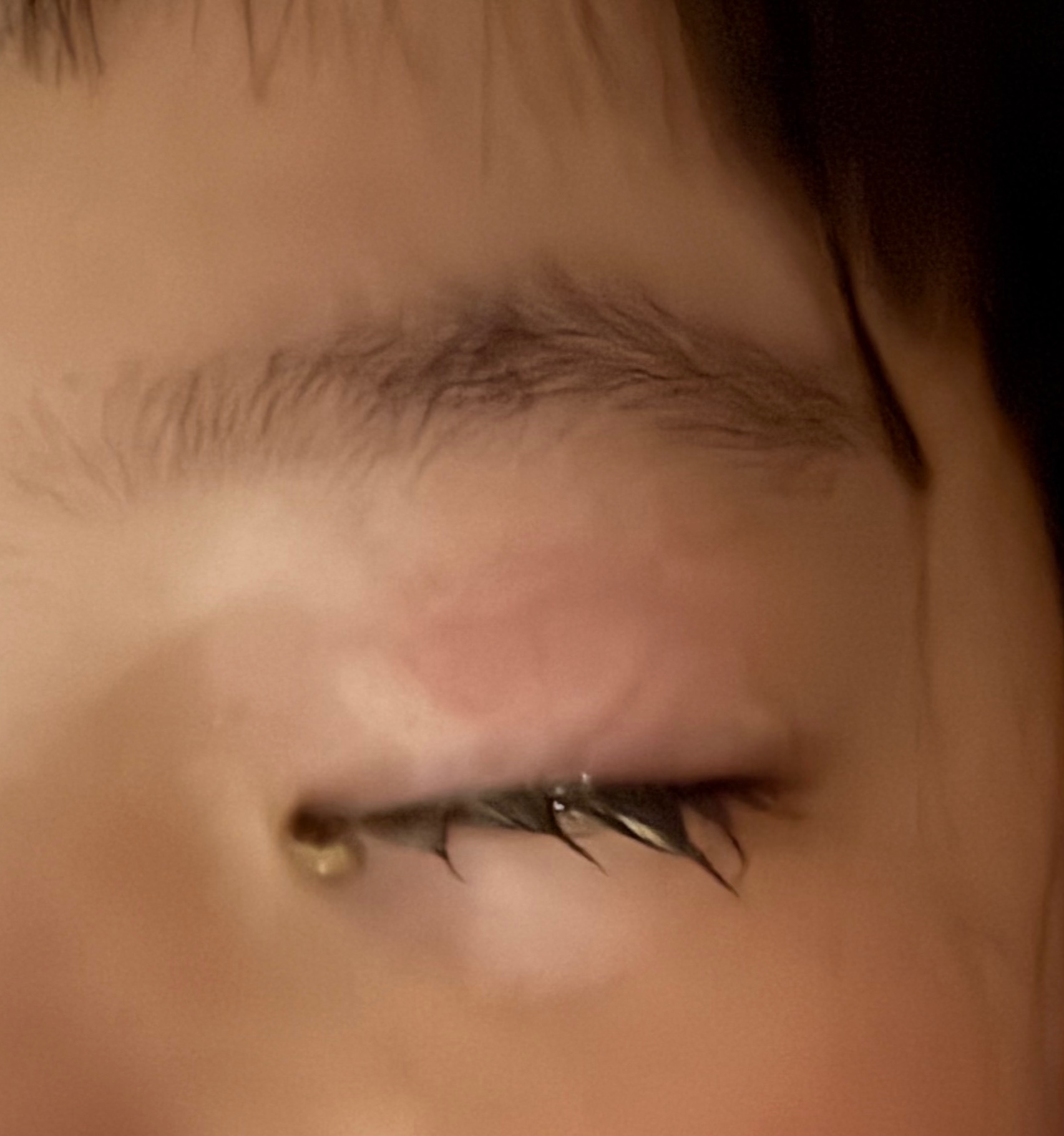실제 아이가 아팠던 눈질환 자는동안의 눈곱이 형성되고 있다
