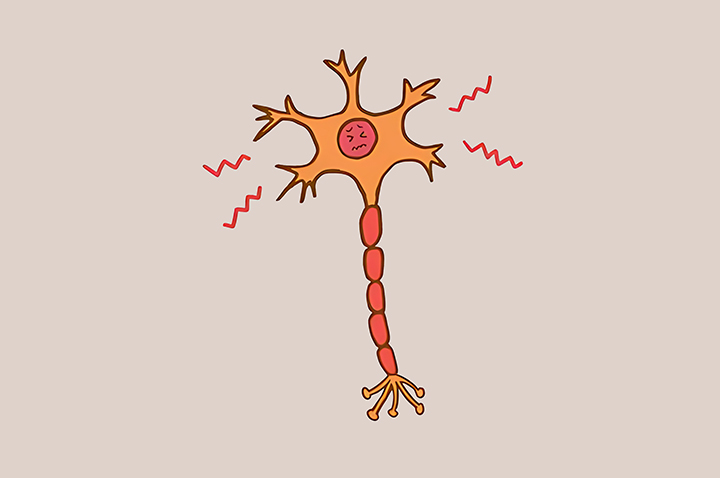 이상증상을-보이는-신경계