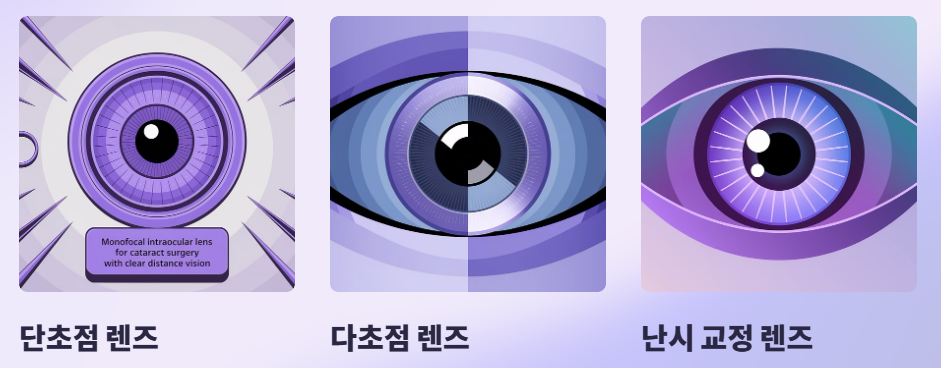 인공 수정체 종류