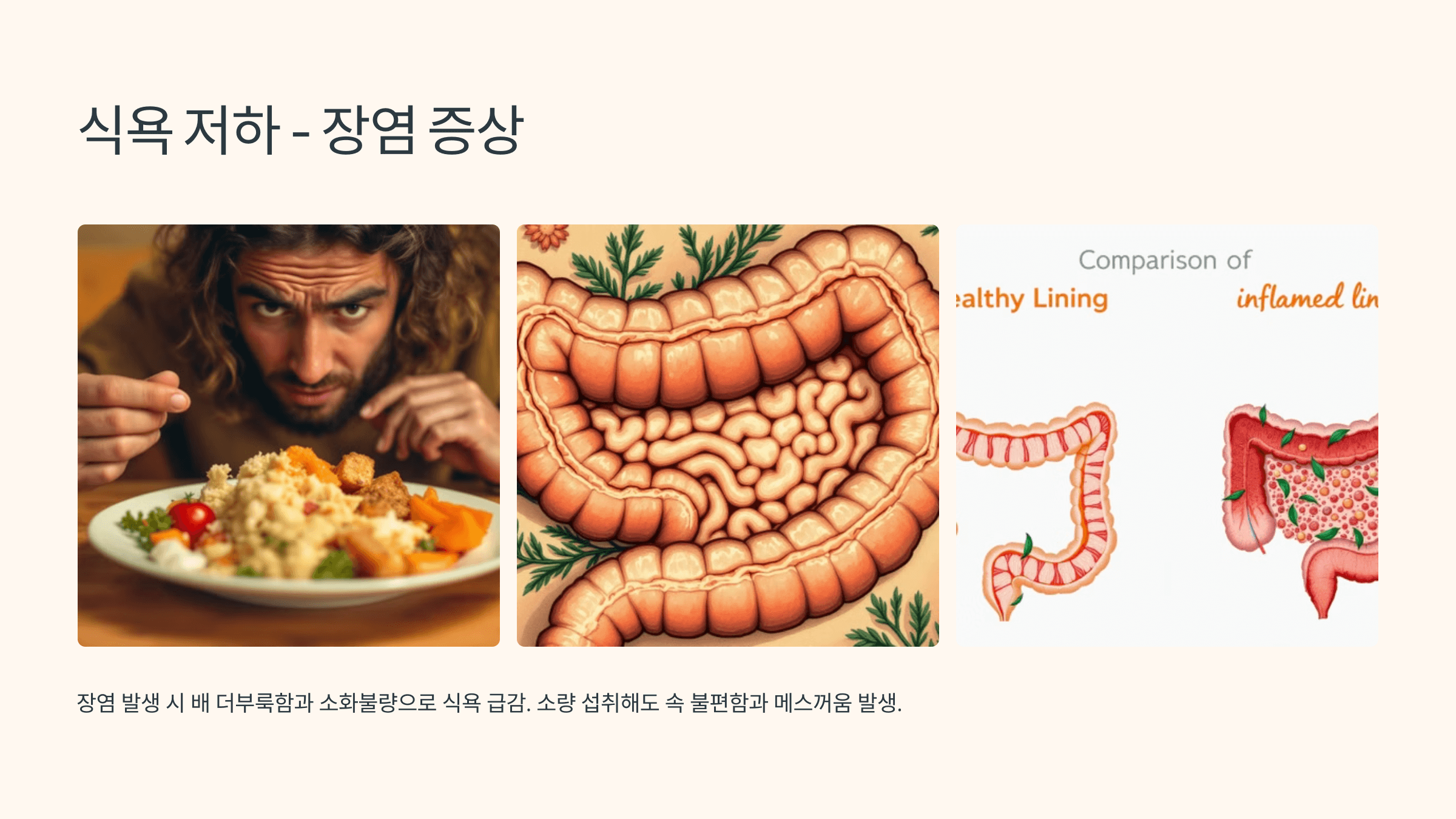 장염과 관련된 사진입니다.
