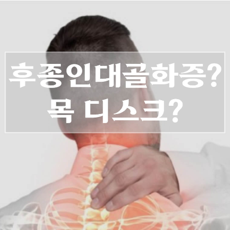 뒷목이-뻐근한-증상