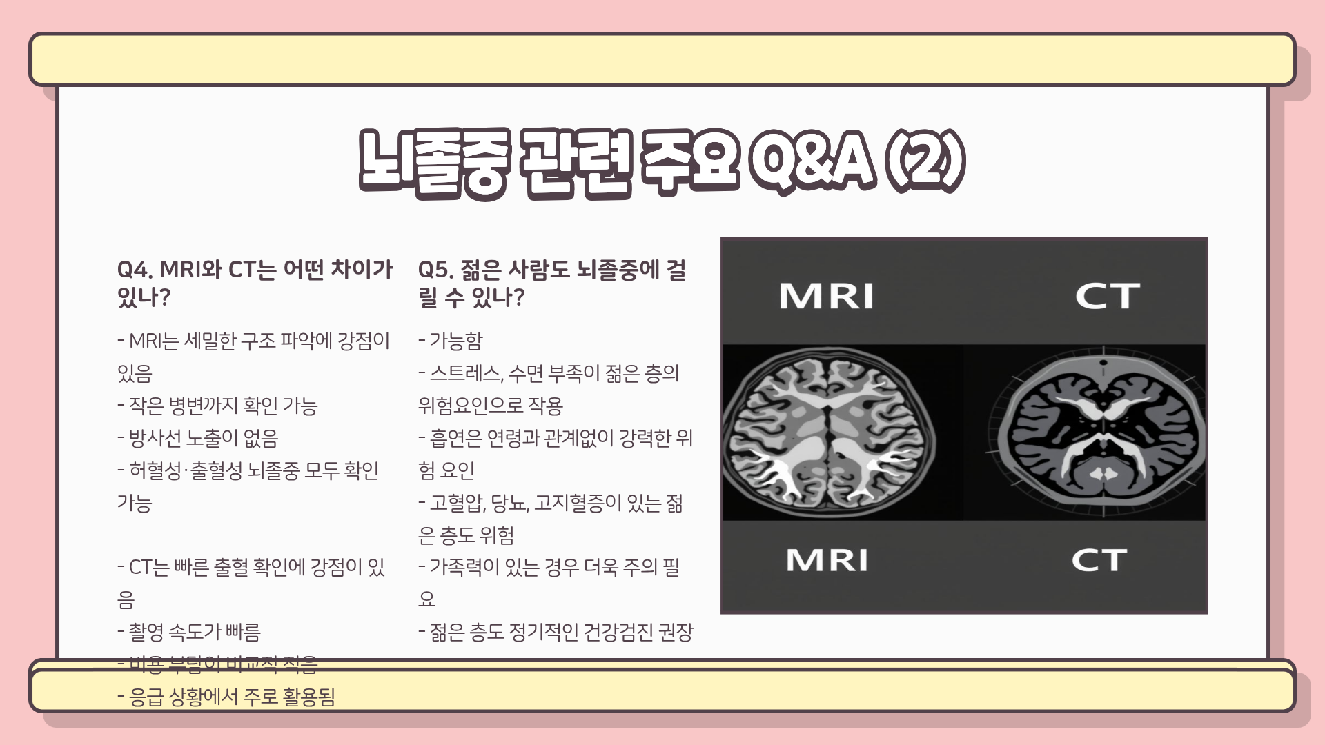 뇌졸중 전조증상 | 뇌졸중 예방법 | 뇌졸중 검사방법 완벽정리, 놓치면 돌이킬 수 없다