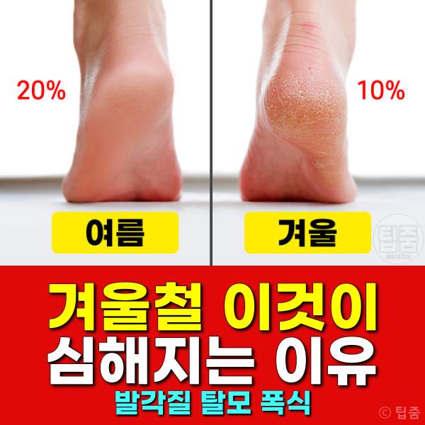 발각질 제거,탈모,다이어트,폭식,면역력