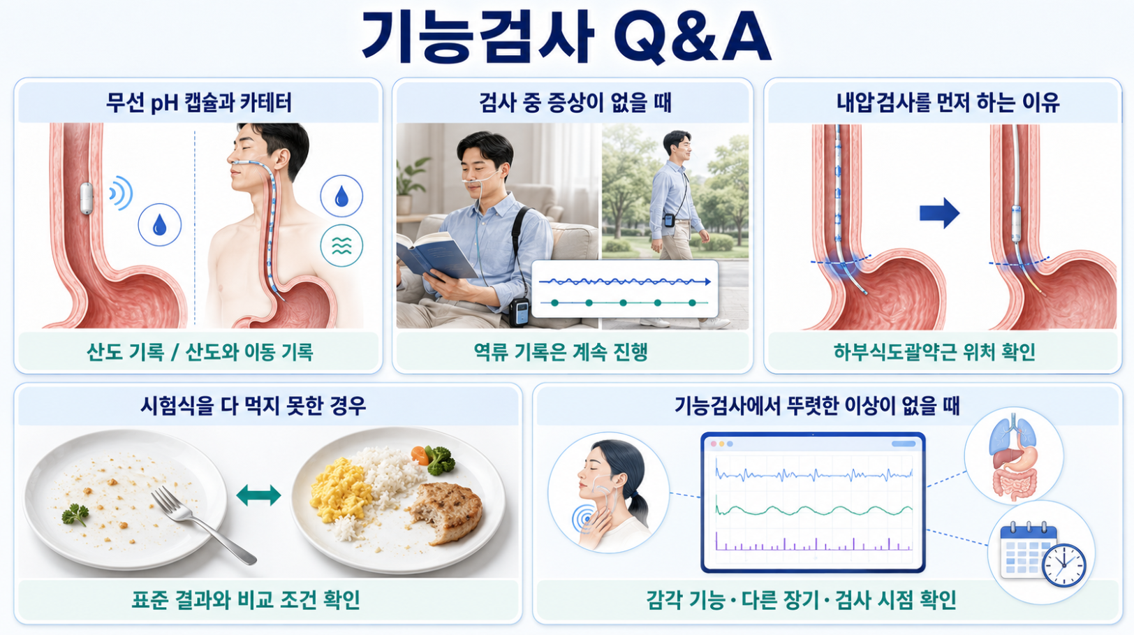 무선 pH 캡슐·역류 기록·카테터 위치·시험식 관련 기능검사 Q&A