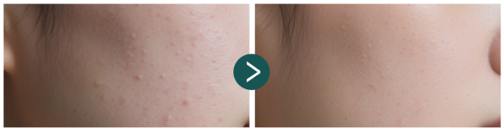 리쥬올 리페어크림 사용 전후